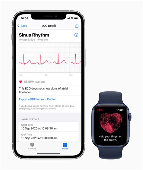 ecg result validity period philippines|Take an ECG with the ECG app on Apple Watch.